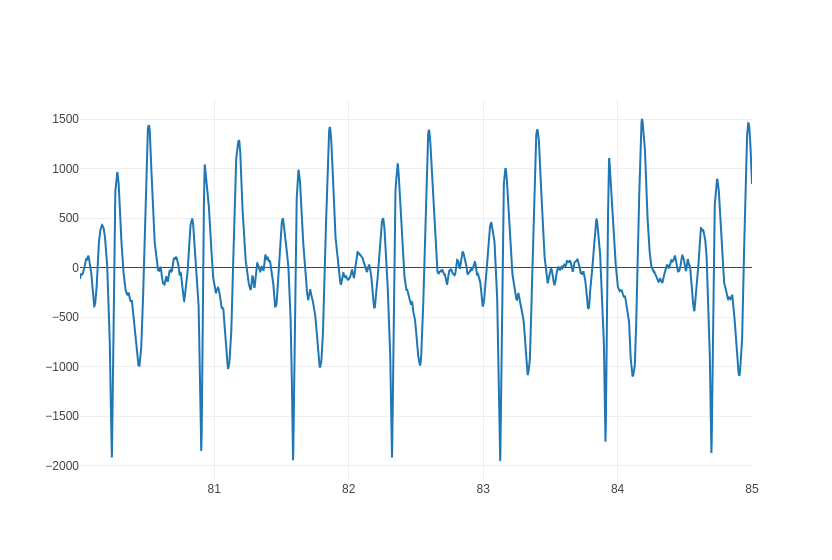 EKG Labeler App
