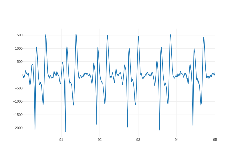 EKG Labeler App