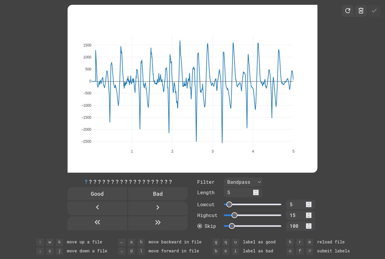 EKG Labeler App
