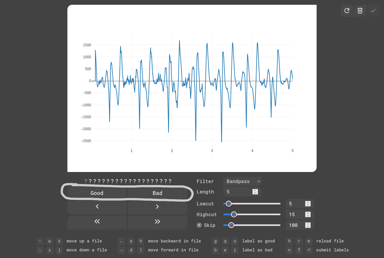 EKG Labeler App