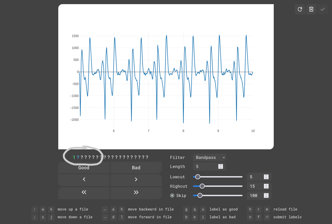 EKG Labeler App