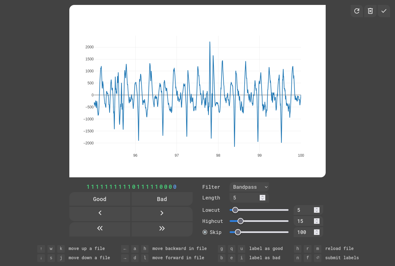 EKG Labeler App