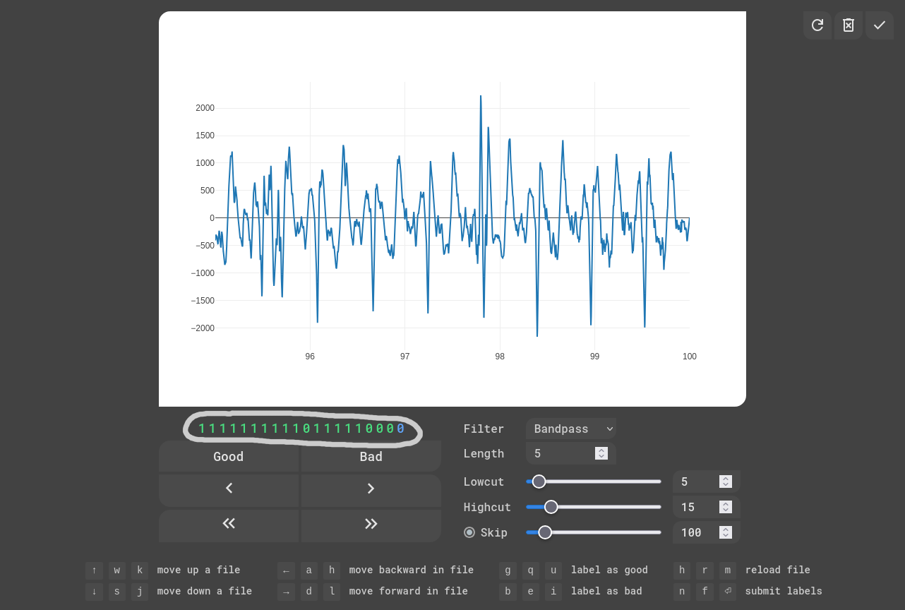 EKG Labeler App