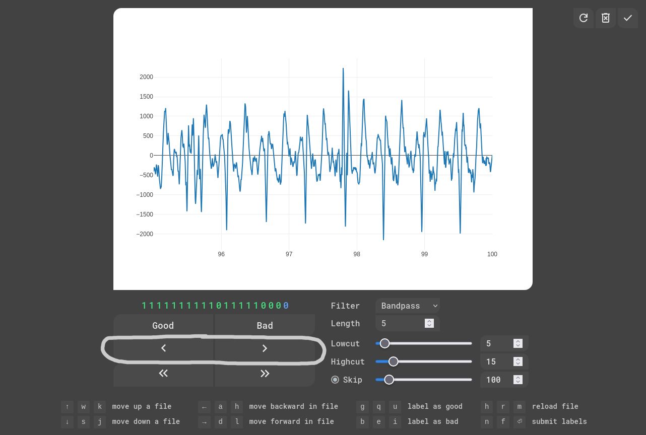 EKG Labeler App