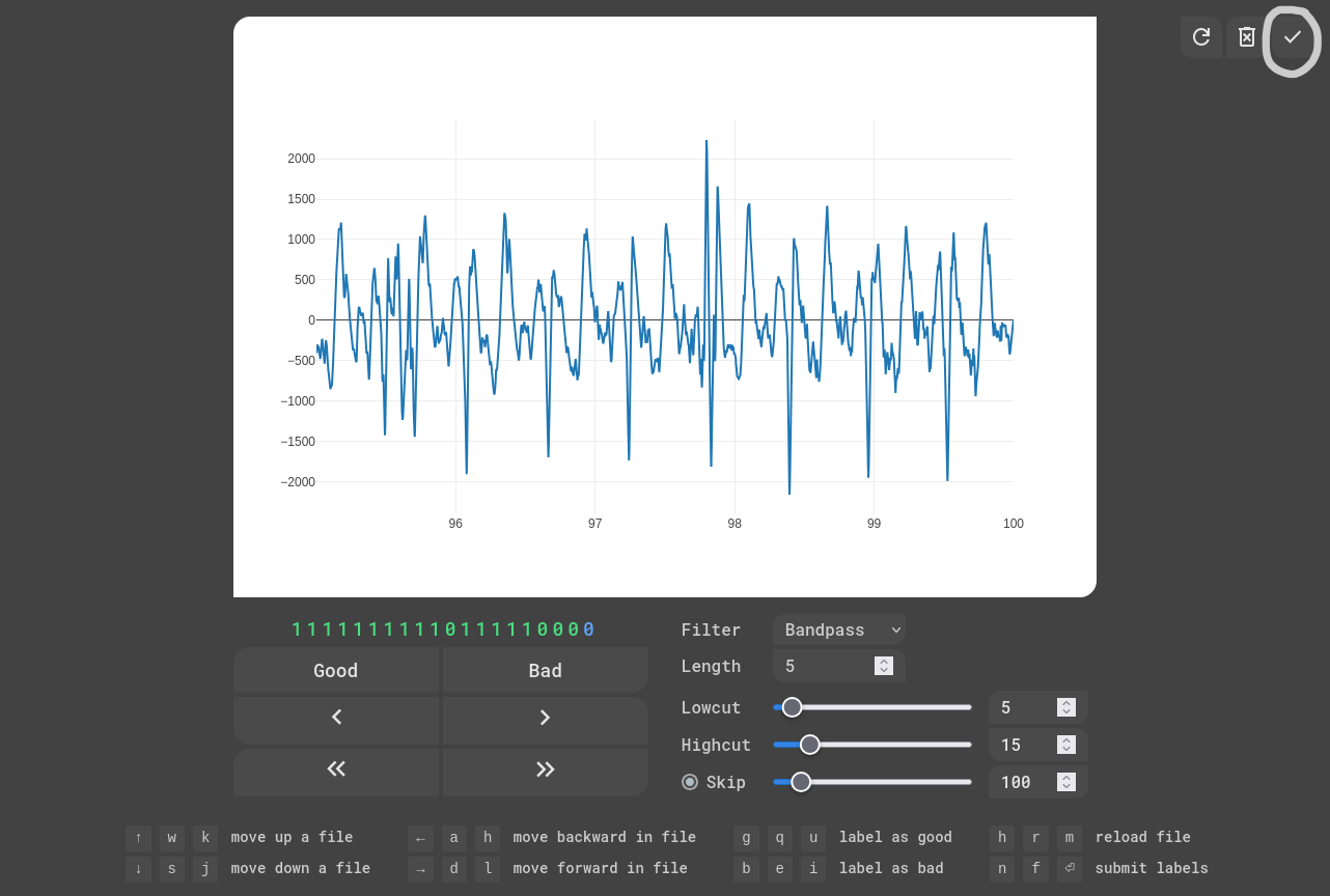 EKG Labeler App