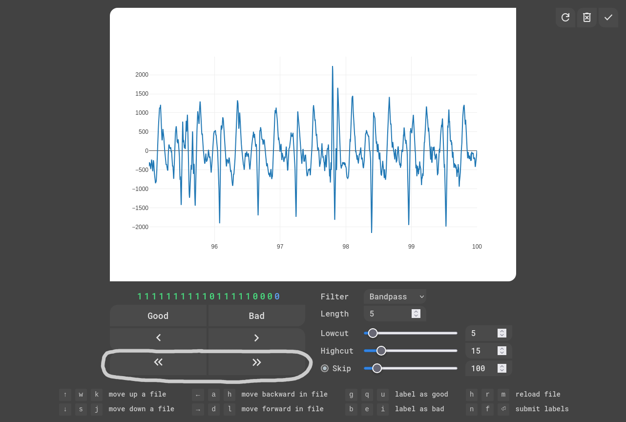 EKG Labeler App