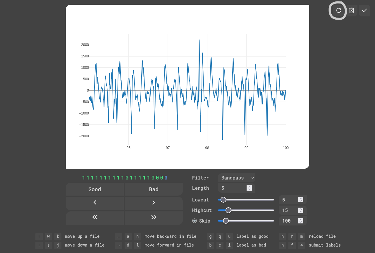 EKG Labeler App