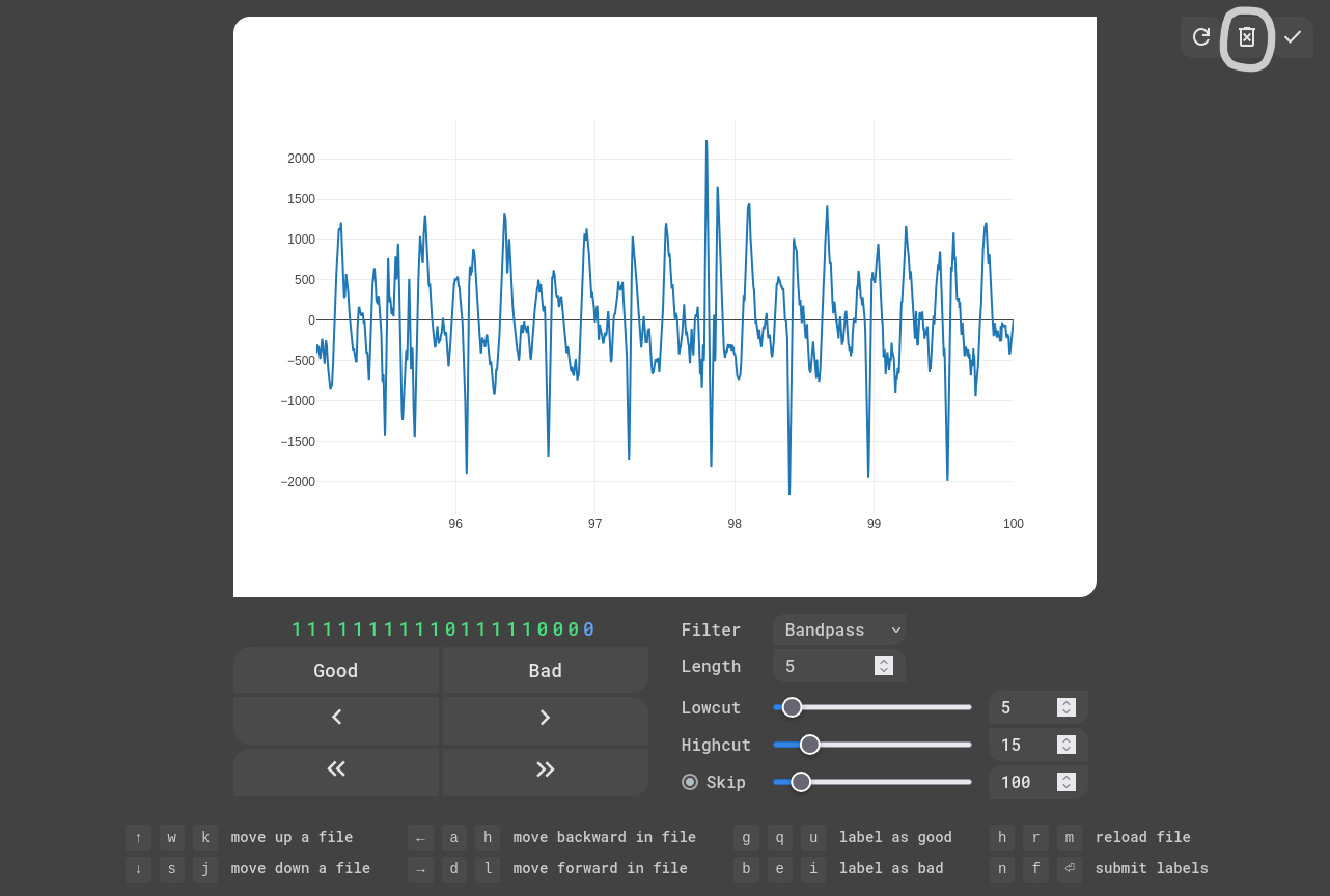 EKG Labeler App
