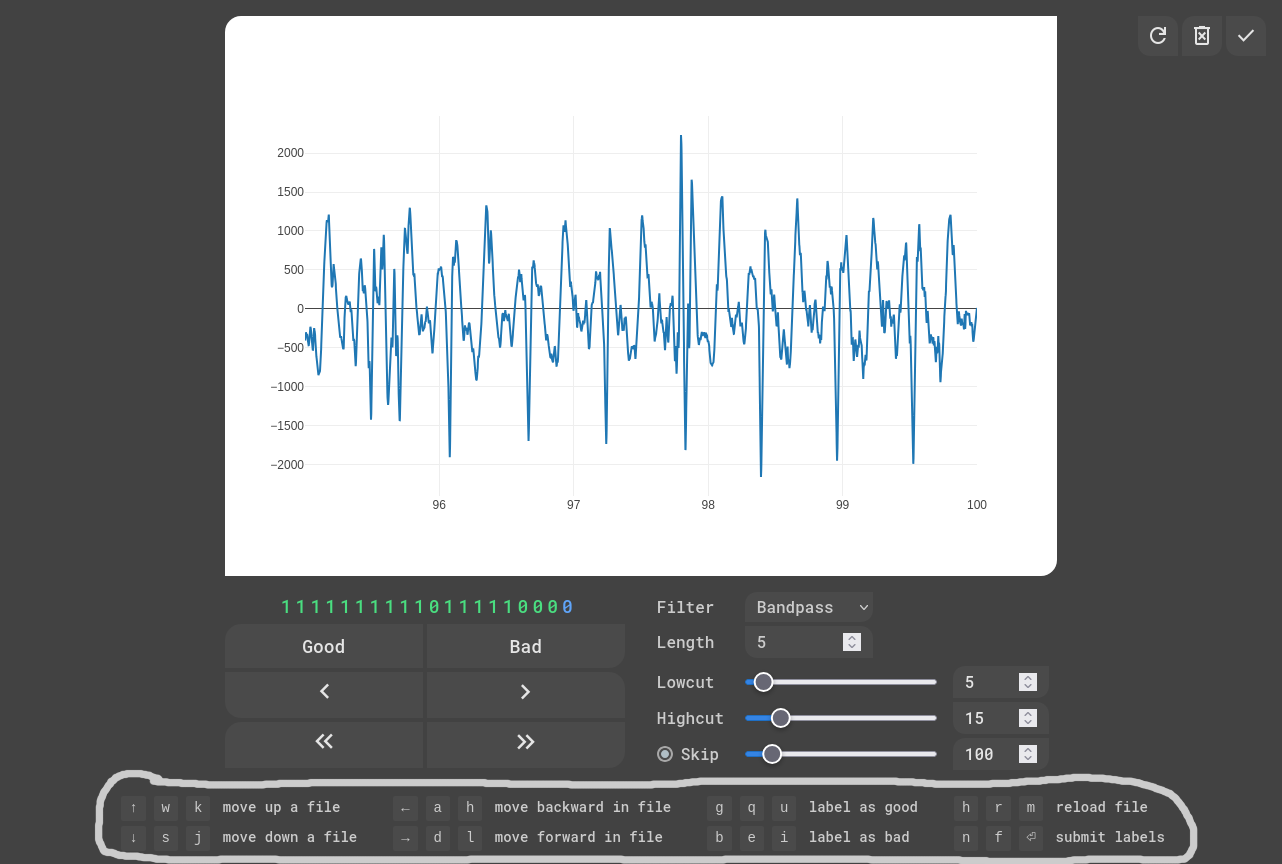 EKG Labeler App