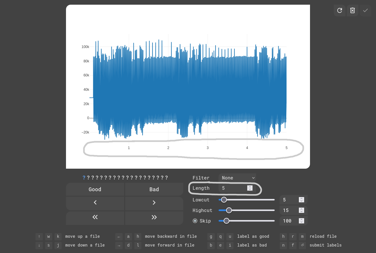 EKG Labeler App