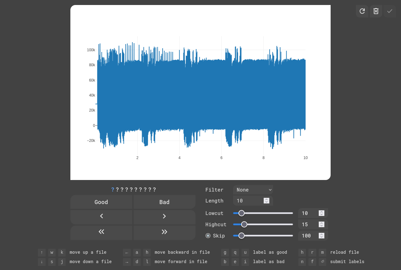 EKG Labeler App