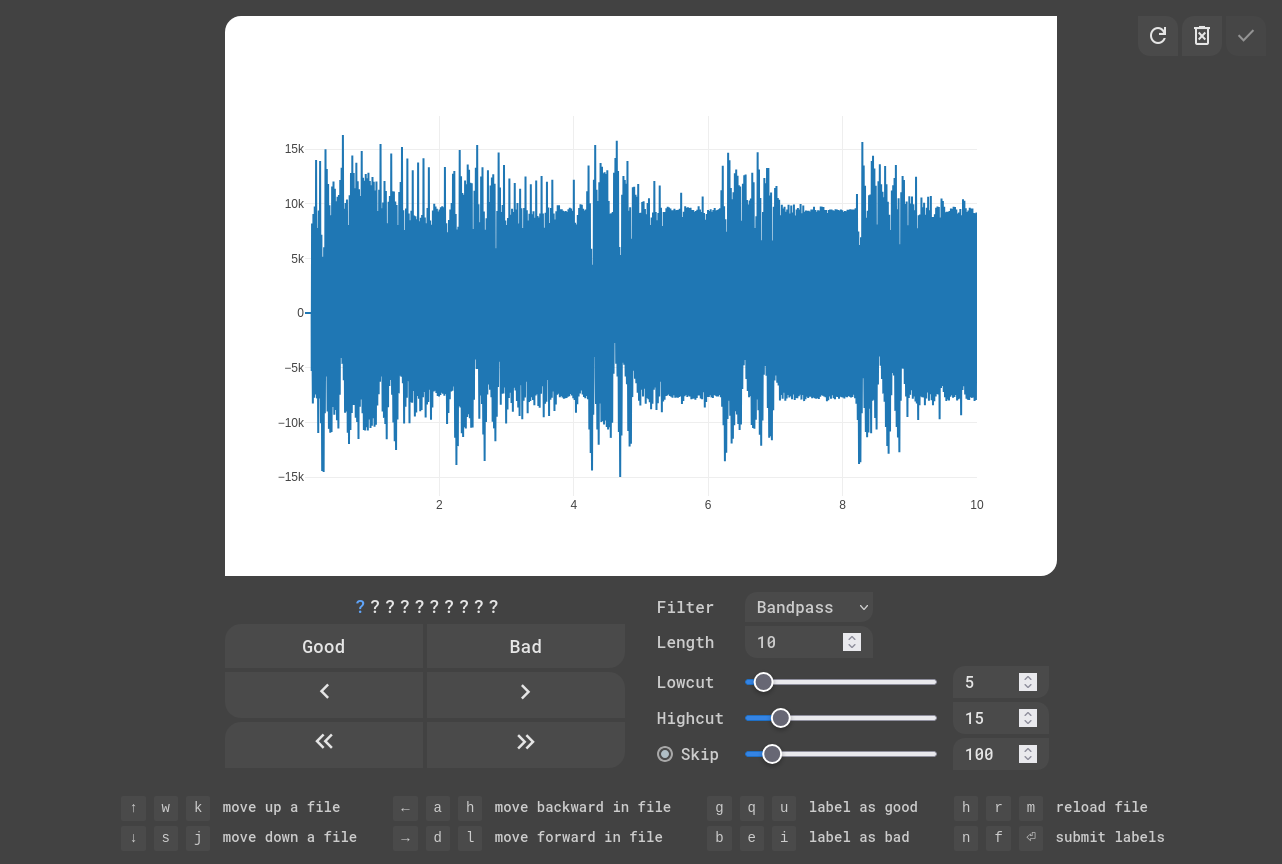 EKG Labeler App