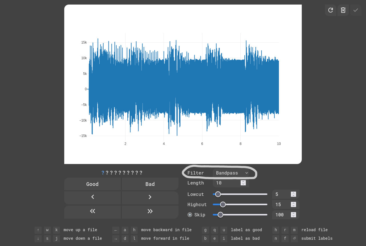 EKG Labeler App