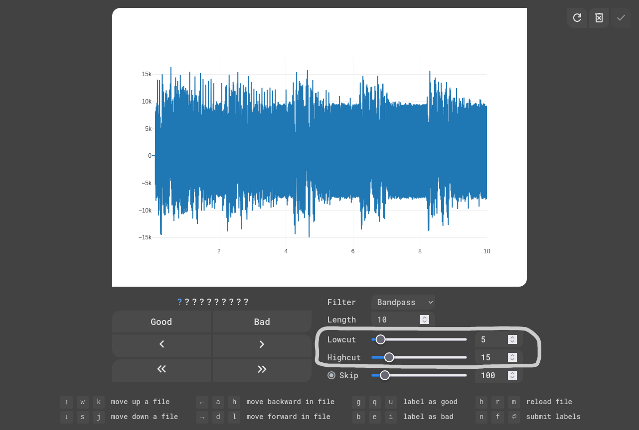 EKG Labeler App