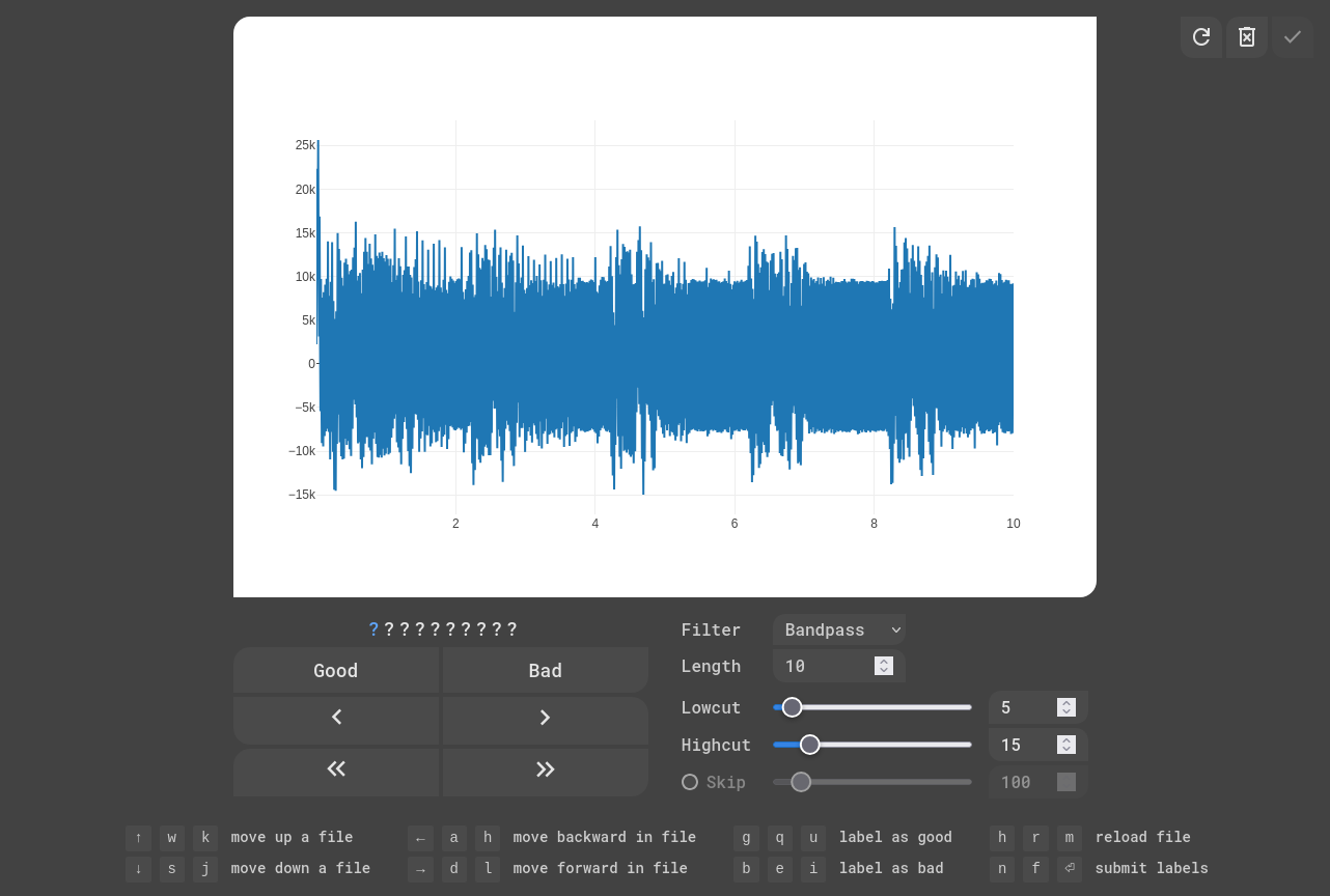 EKG Labeler App