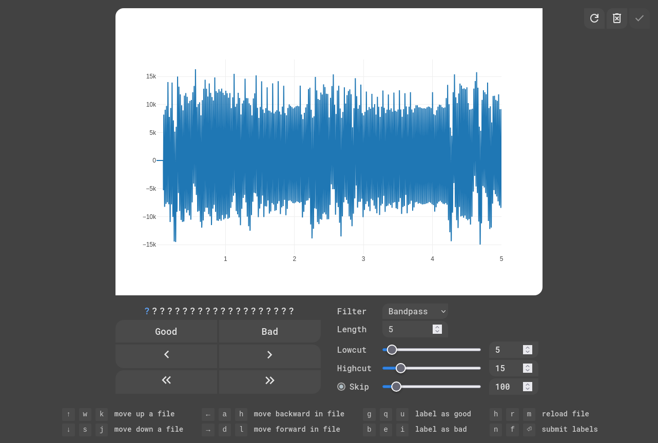 EKG Labeler App