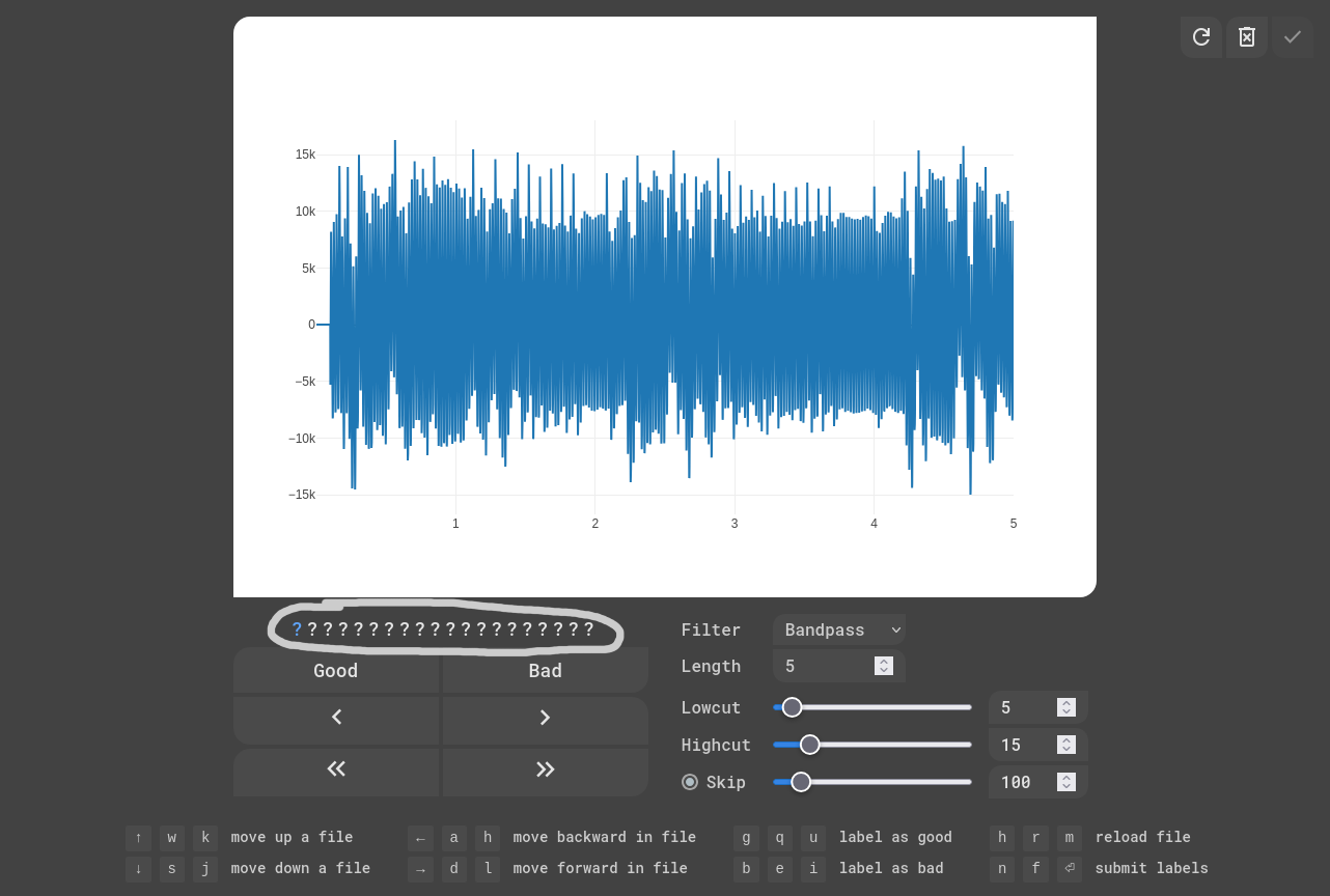 EKG Labeler App